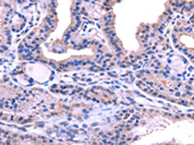 TRIM14 Antibody