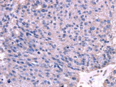 TRIM14 Antibody
