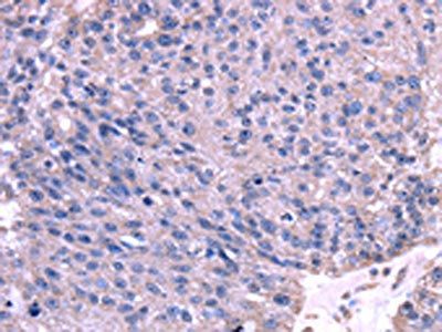 TRIM14 antibody