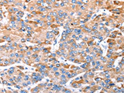 TRIM14 Antibody