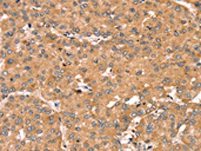TRIM14 Antibody
