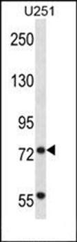 TRIM2 antibody