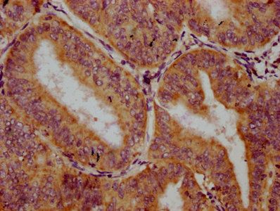 TRIM26 Antibody