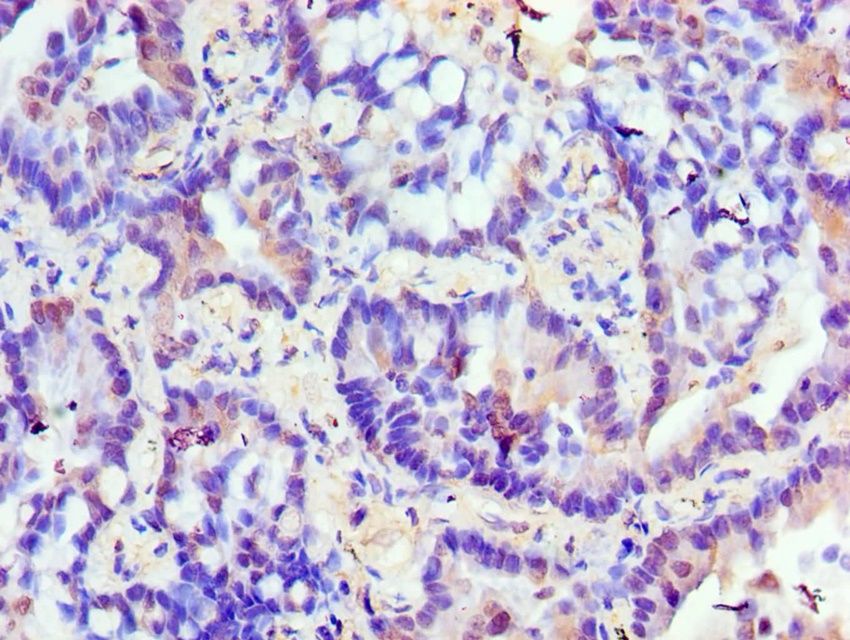 TRIM27 Antibody