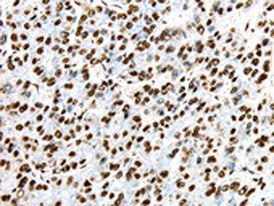 TRIM27 Antibody