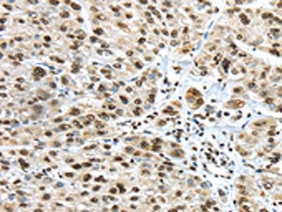 TRIM27 Antibody