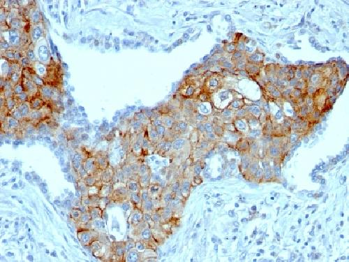TRIM29 (Lung Squamous Cell Carcinoma Marker) Antibody