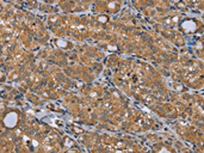 TRIM29 Antibody