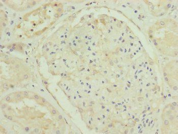 TRIM31 Antibody