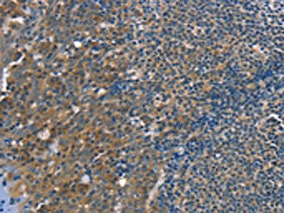TRIM31 Antibody
