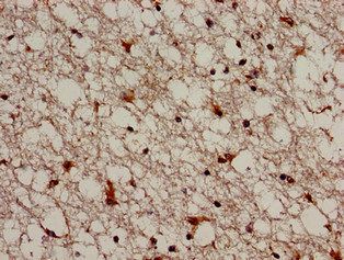 TRIM33 Antibody
