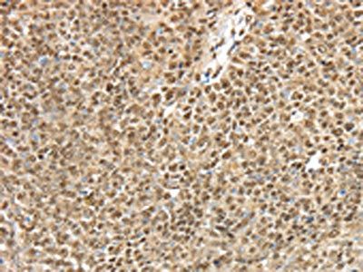 TRIM33 Antibody