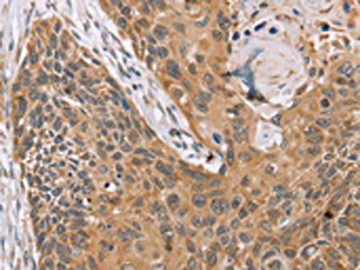 TRIM34 Antibody