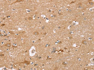 TRIM34 Antibody