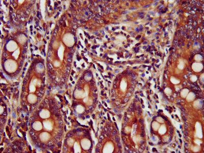 TRIM35 Antibody