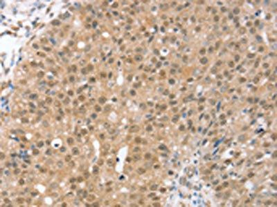 TRIM35 Antibody