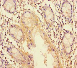 TRIM37 Antibody