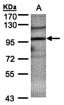 TRIM37 antibody