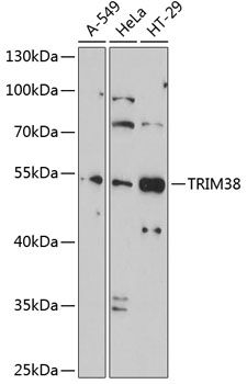 TRIM38 antibody