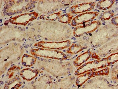 TRIM39 Antibody