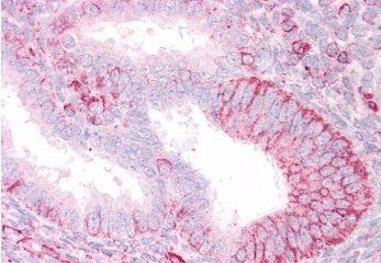 Goat anti-RNF23 / TRIM39 Antibody