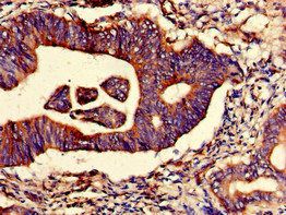 TRIM4 Antibody