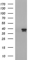 TRIM44 Antibody
