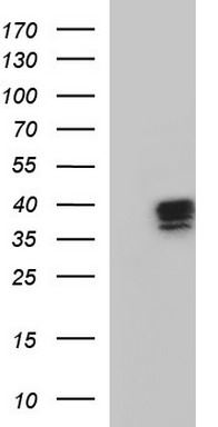 TRIM44 Antibody