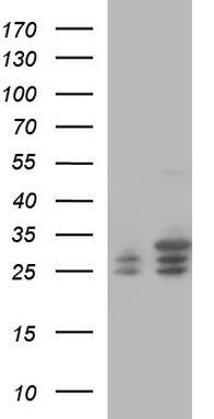 TRIM45 antibody