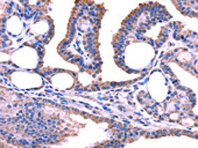 TRIM49 Antibody