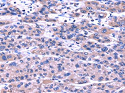 TRIM49 Antibody