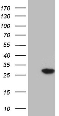 TRIM56 Antibody