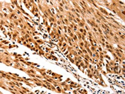 TRIM63 Antibody