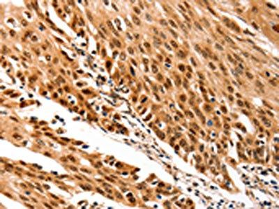 TRIM63 antibody