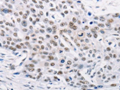 TRIM63 Antibody