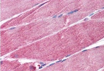 Goat anti-MURF1 / TRIM63 (internal) Antibody