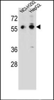 TRIM64 antibody