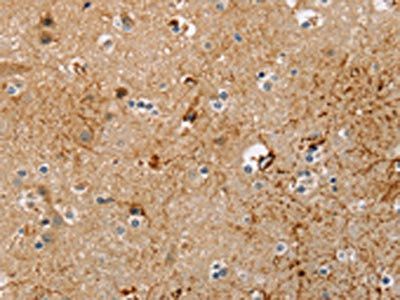 TRIM69 Antibody