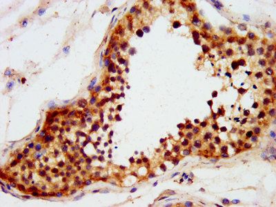 TRIM71 Antibody