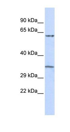 TRIM8 antibody