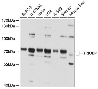 TRIOBP antibody