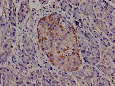 TRIP10 Antibody