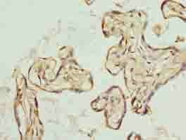 TRIP13 Antibody