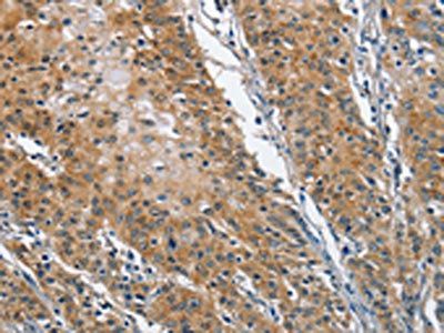 TRIP4 Antibody