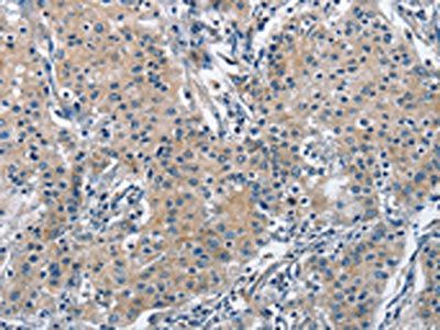 TRIP4 Antibody