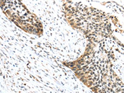 TRIP6 Antibody