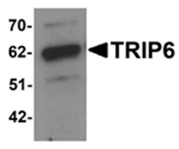 TRIP6 Antibody