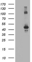 Tristetraprolin (ZFP36) antibody