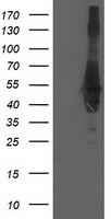 Tristetraprolin (ZFP36) antibody