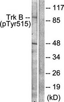Trk B (phospho-Tyr515) antibody